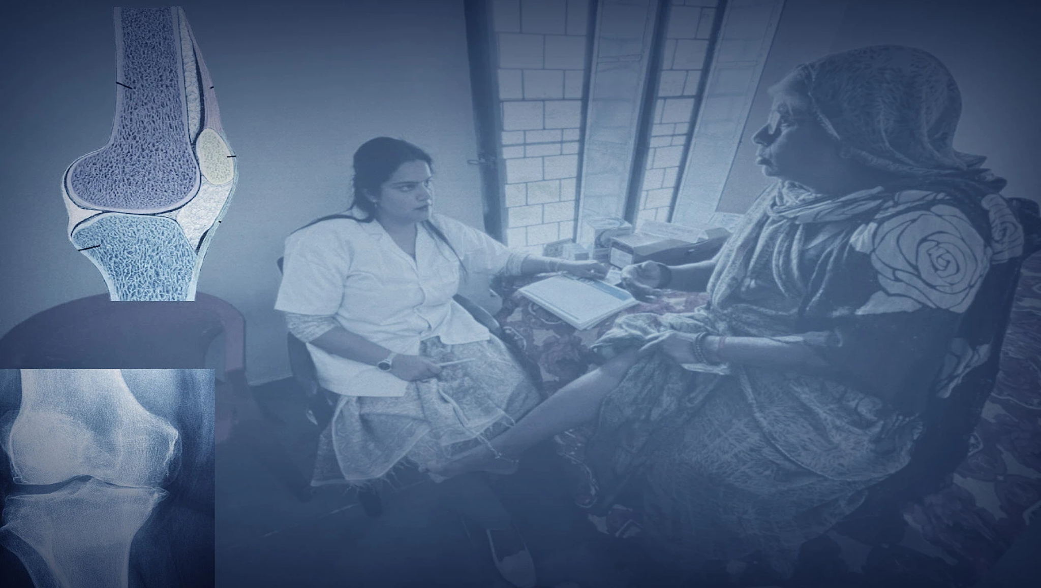 Effective remedies for joint pain and its causes in physiotherapy aayu physio home care